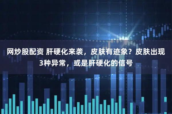 网炒股配资 肝硬化来袭，皮肤有迹象？皮肤出现3种异常，或是肝硬化的信号